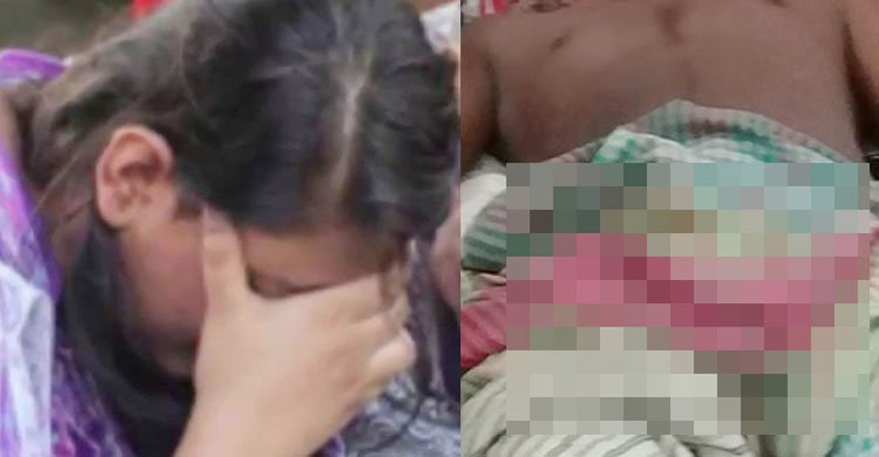নওগাঁয় ঘুমন্ত স্বামীর গোপনাঙ্গ কেটে দিলেন স্ত্রী