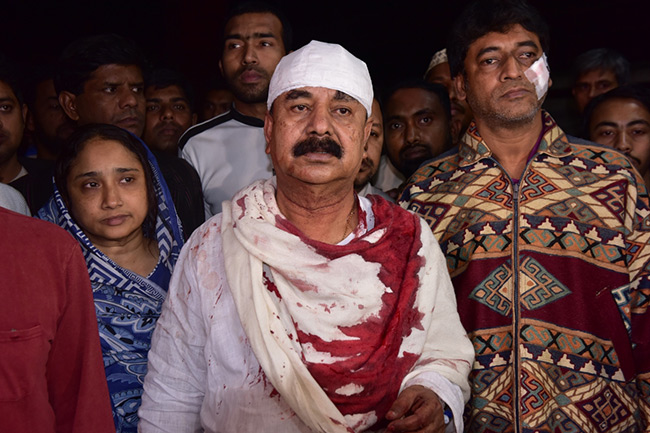 গয়েশ্বরের ওপর হামলার ঘটনায় যুবলীগ ও স্বেচ্ছাসেবক লীগের তিন নেতা গ্রেপ্তার