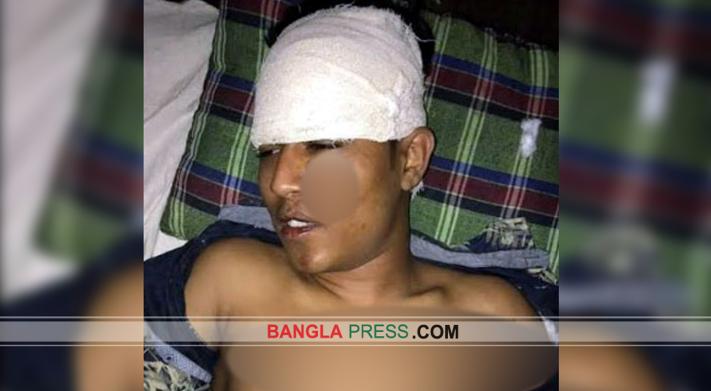 ঝিনাইদহে ১ জনকে কুপিয়ে জখম