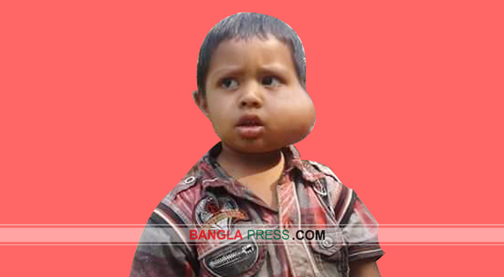 শিশু মুস্তাকিনকে বাঁচাতে সাহায্যের আবেদন