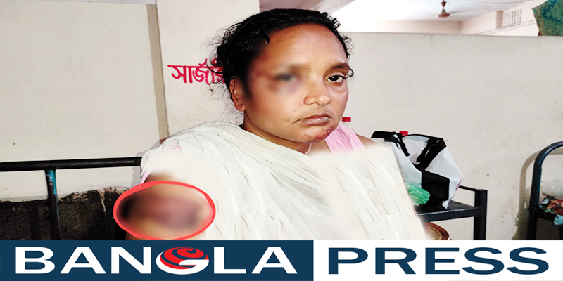 যৌতুক লোভী স্বামীর হাতে স্ত্রী নির্যাতন