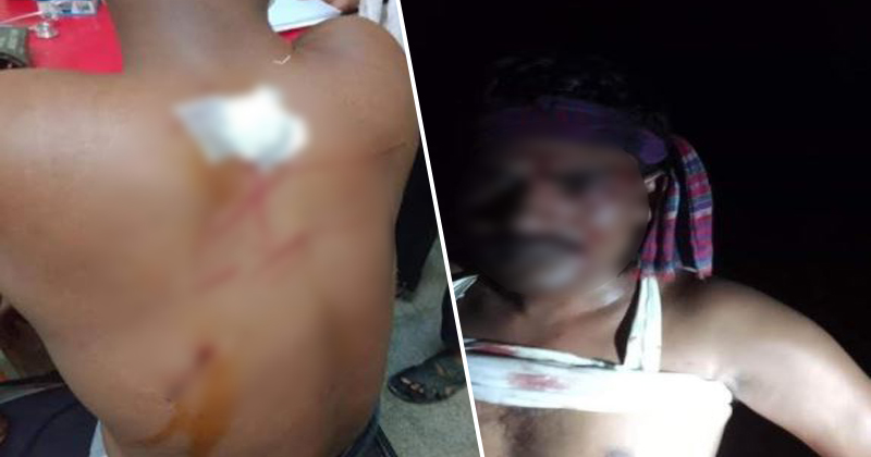 রামগঞ্জে শিশু সন্তানের সামনে বাবাকে কুপিয়ে হত্যার চেষ্টা