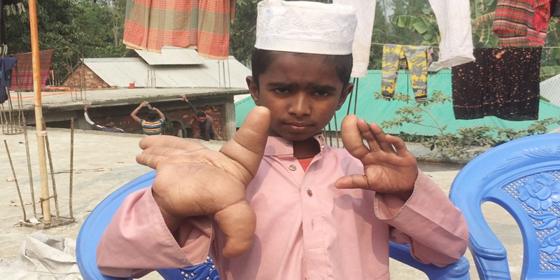এ কোন রোগে ভুগছে শিশু রেহাকুল!