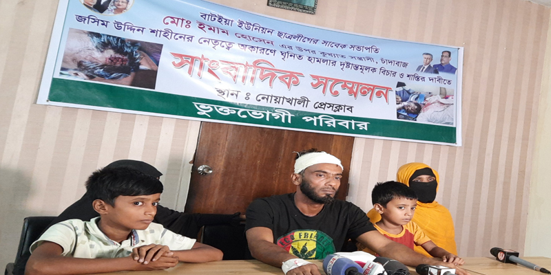 এমপির ইফতারে যাওয়ায় যুবককে হাতুড়িপেটা, বাড়ি-ঘরে হামলা-অগ্নিসংযোগ
