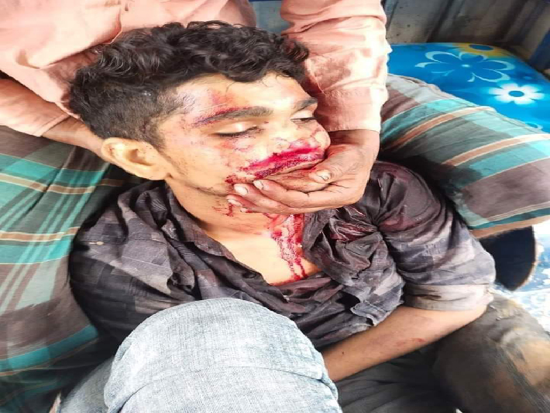 মহিষকে পানি খাওয়াতে যাওয়ার পথে কিশোরের মৃত্যু 