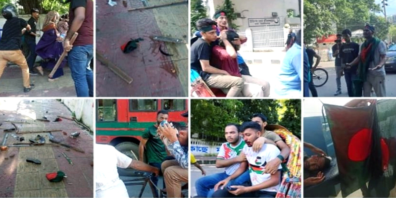 কোটা আন্দোলন: ছাত্রলীগের হামলায় আহত শতাধিক শিক্ষার্থী