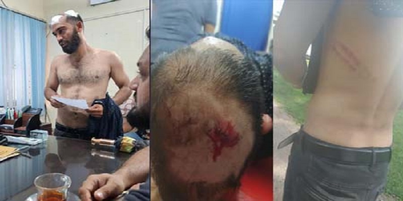 কোম্পানীগঞ্জে বাসে বেশি ভাড়া নেওয়ার প্রতিবাদ করায় মাথা ফাটালো যাত্রীর